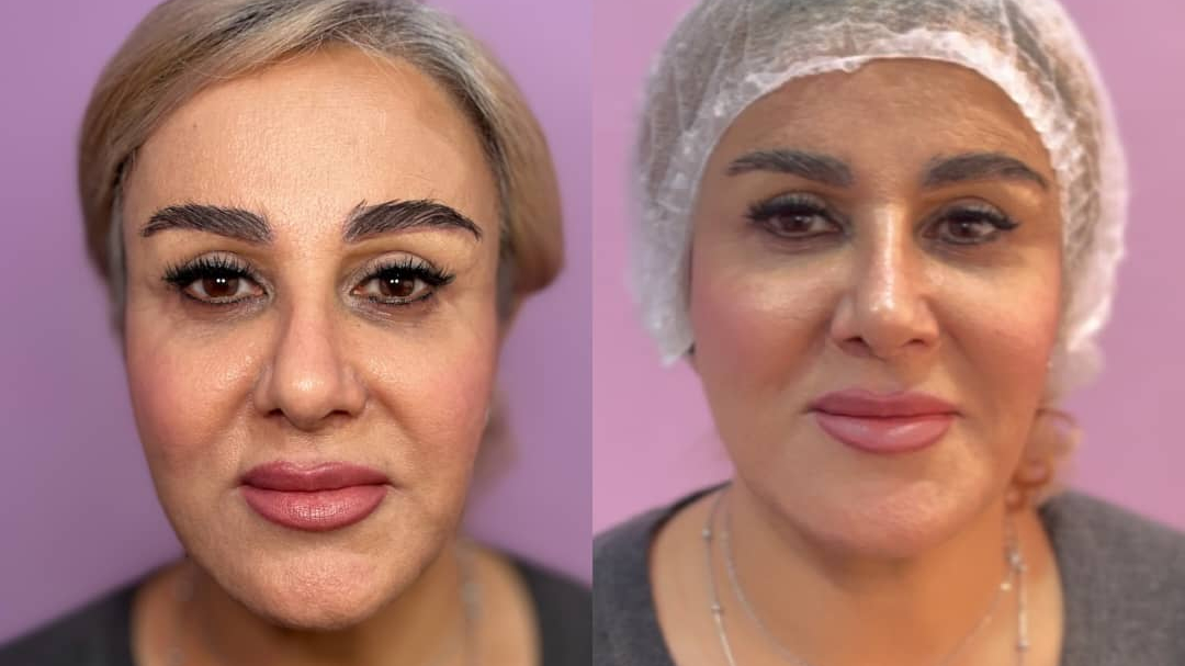 کلینیک پوست مو و زیبایی دکتر زلفی