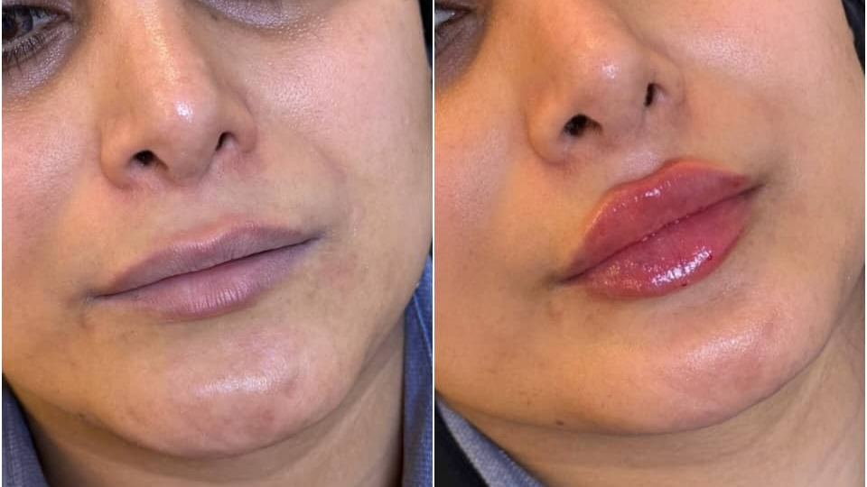 کلینیک پوست مو زیبایی و لیزر کیمیا