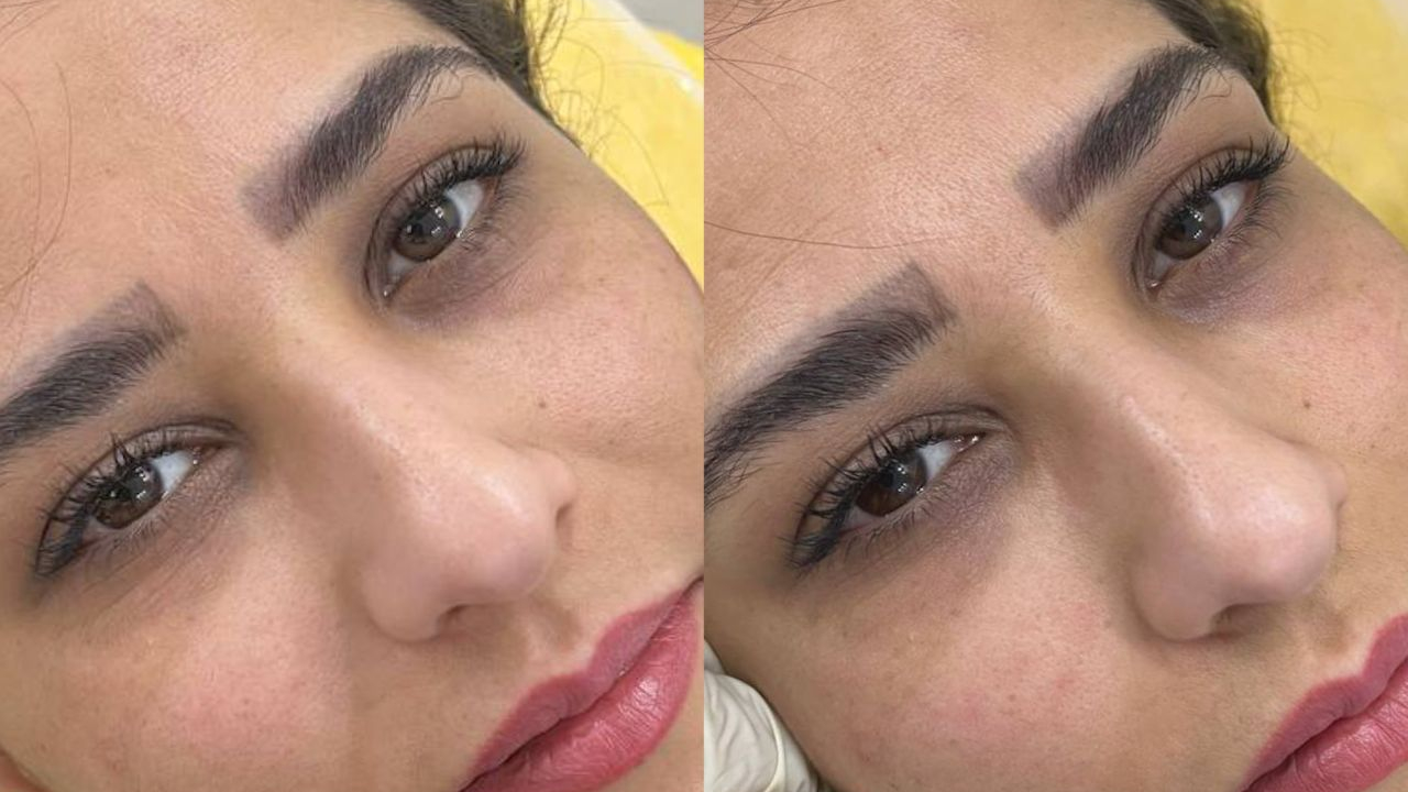مرکز لیزر و کلینیک زیبایی بام بیوتی