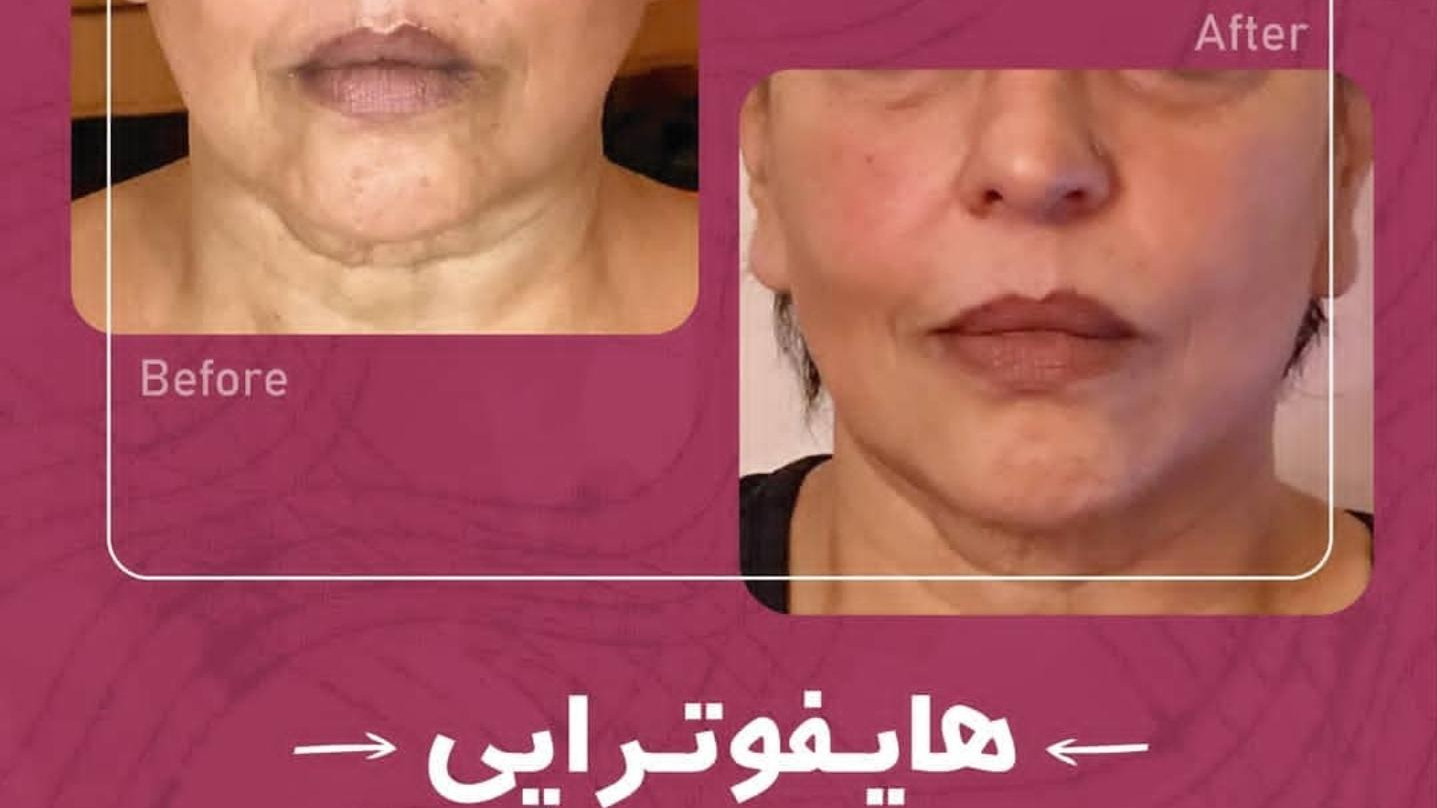 کلینیک پوست و زیبایی دکتر مهدی میمنت