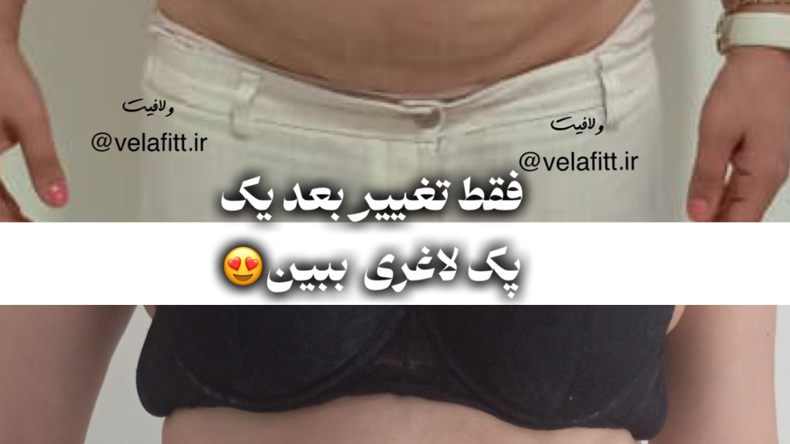 کلینیک لاغری ولافیت