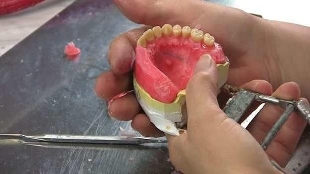 دندانسازی بهروز زنگنه