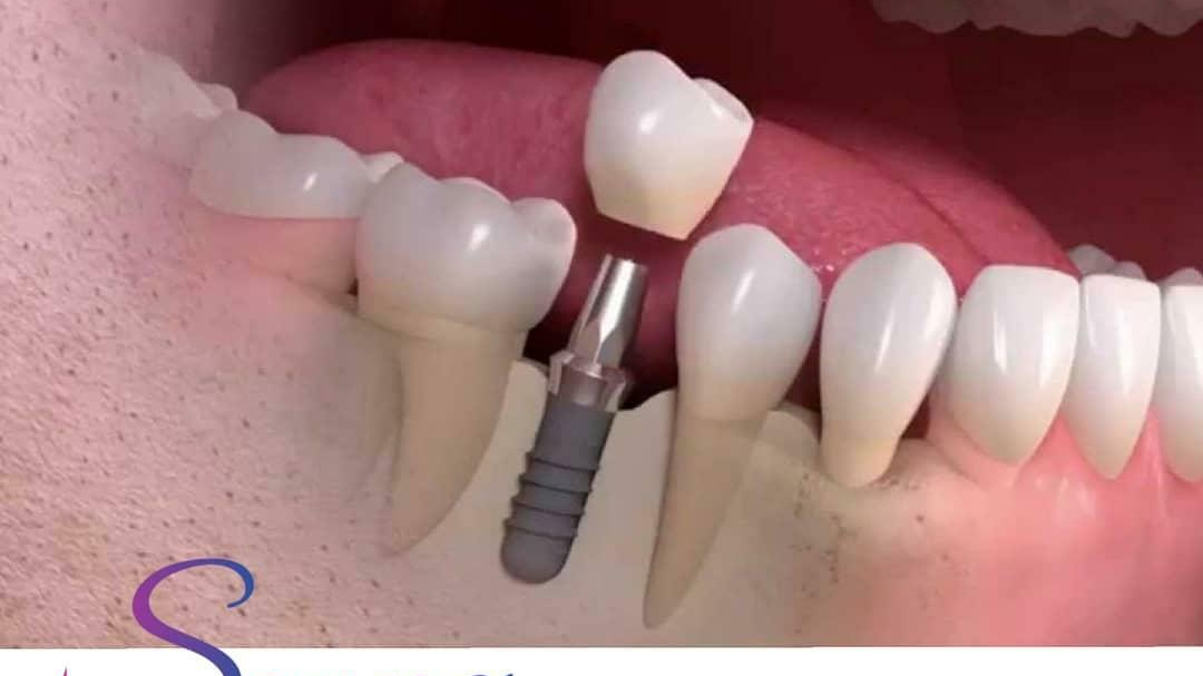 دندانپزشکی دکترعلی ممتازی