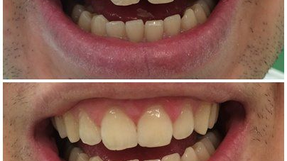 دندانپزشکی دکتر مجتبی نیکوزاده