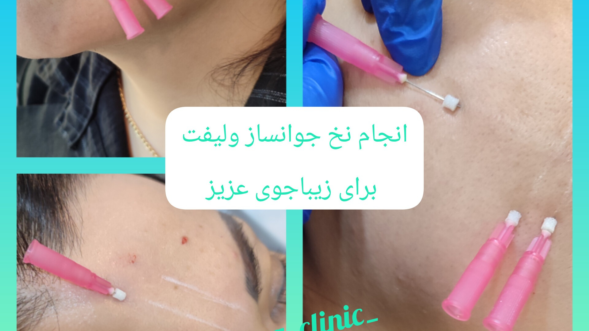 مرکز لیزر و کلینیک زیبایی آرا