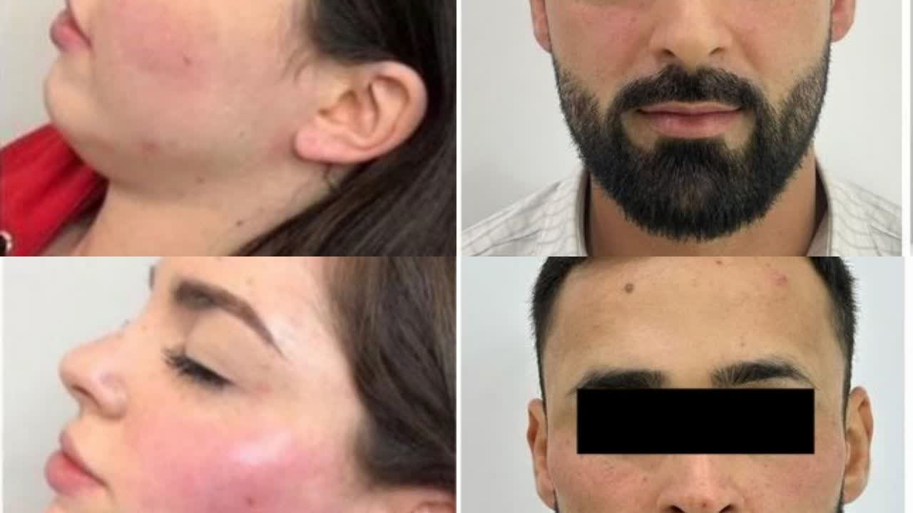 کلینیک زیبایی مه نگار