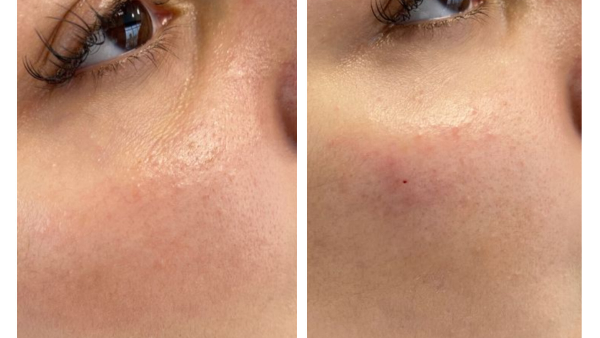 کلینیک پاکسازی پوست و فیشال ژیوان