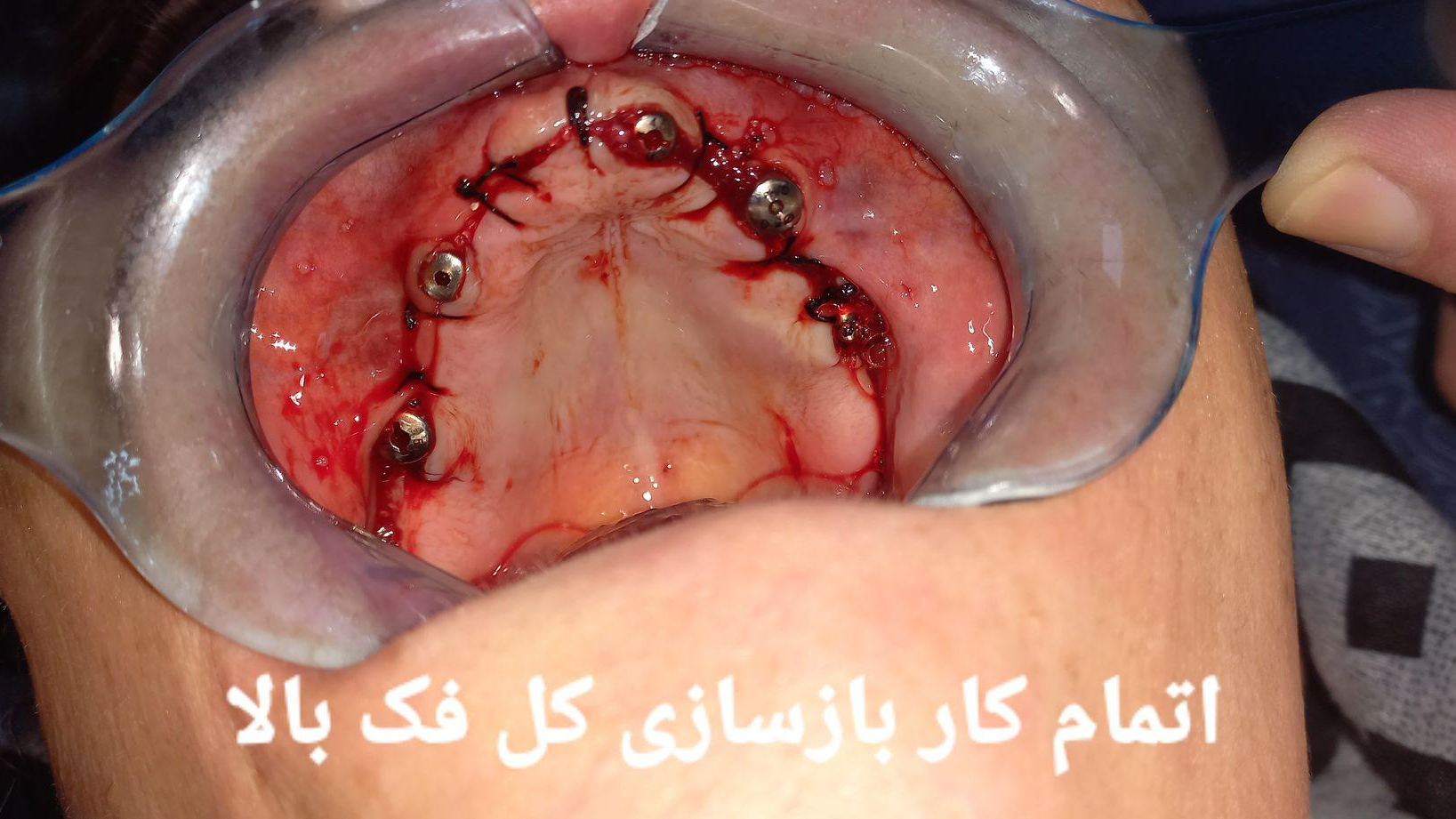 کلینیک دندان پزشکی و ایمپلنت ژیوان