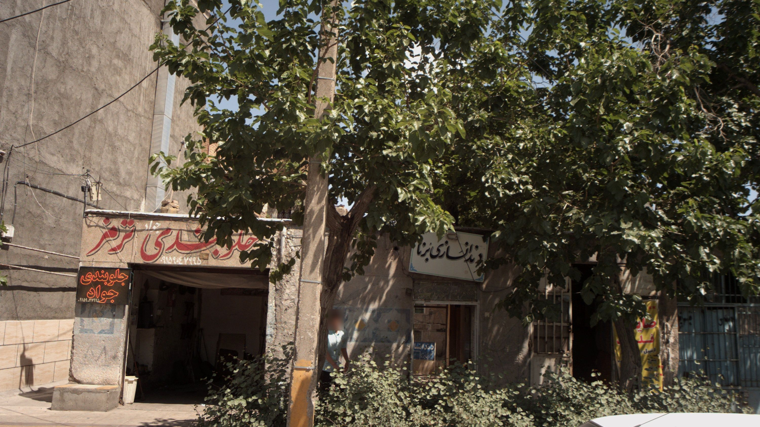 دندانسازی برنا