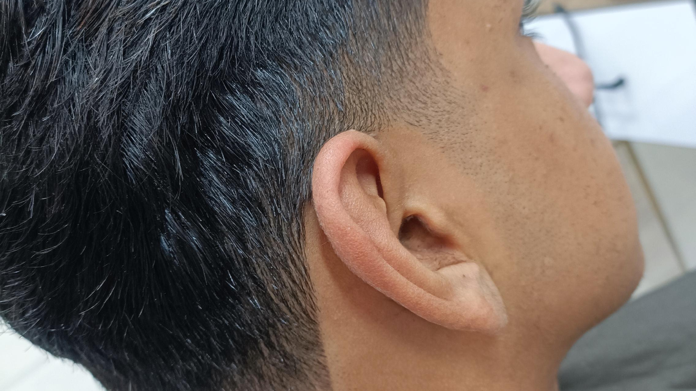 پیرایش هیرکات