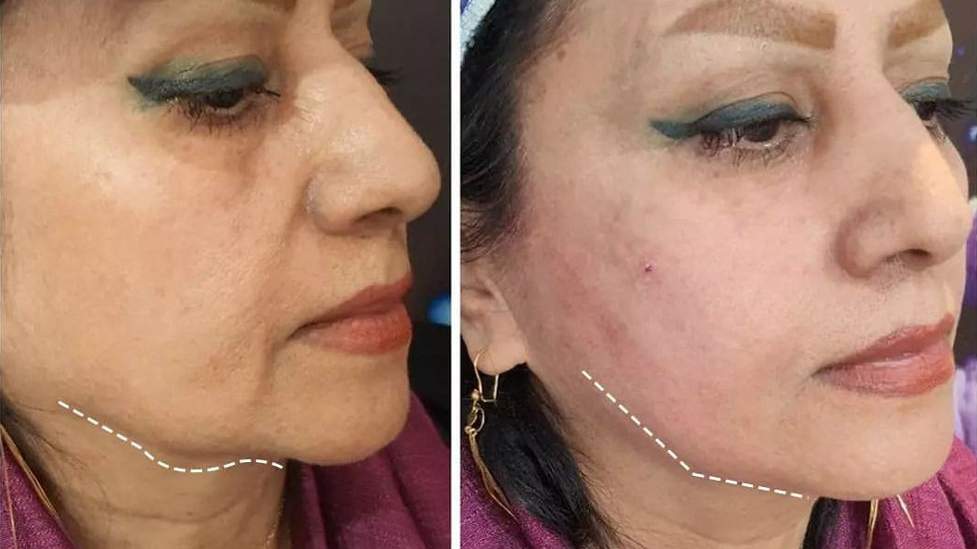 کلینیک پوست لاغری و زیبایی بهارجانا
