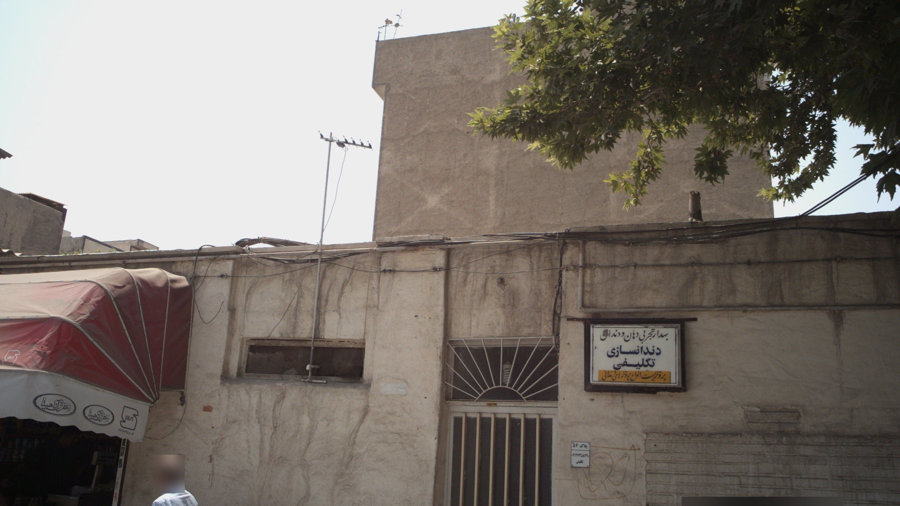 دندانسازی تکلیفی