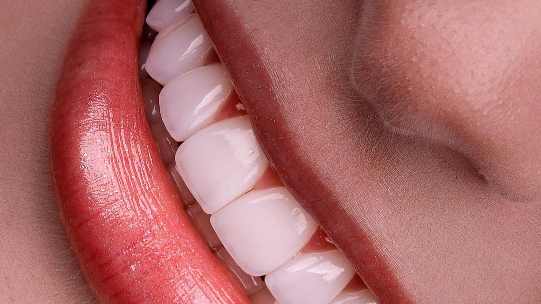 دندانپزشکی و دندانسازی قائم