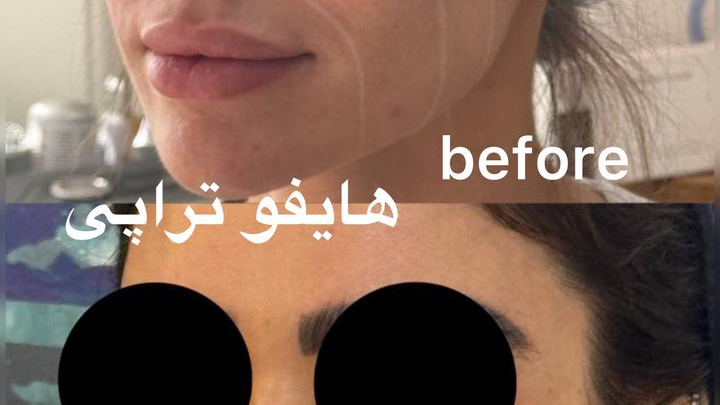 کلینیک زیبایی زرماه