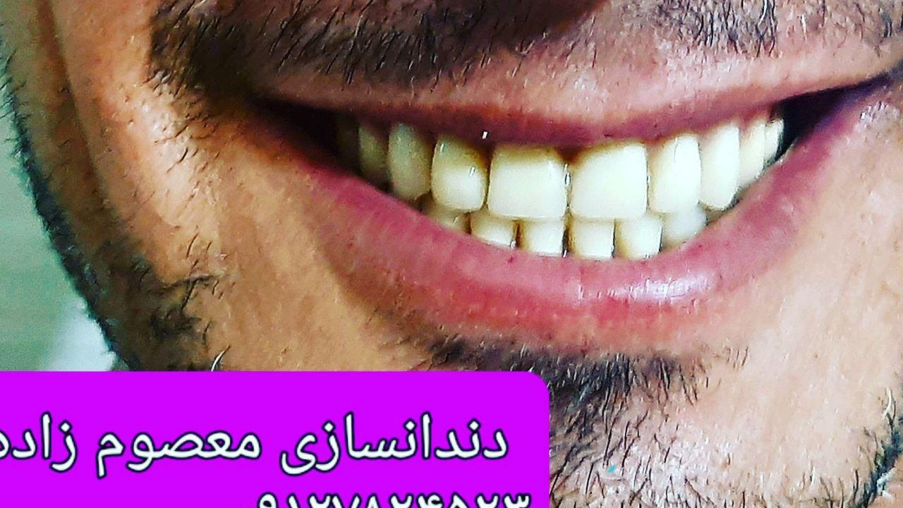 دندان سازی تخصصی معصوم زاده