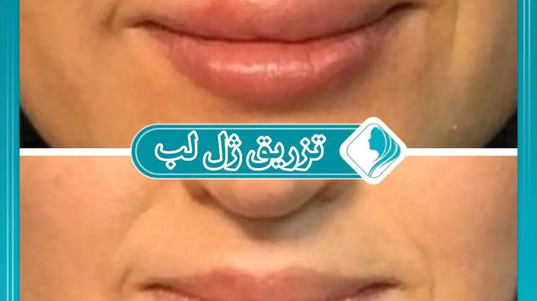 کلینیک تخصصی پوست، مو ،زیبایی ایران