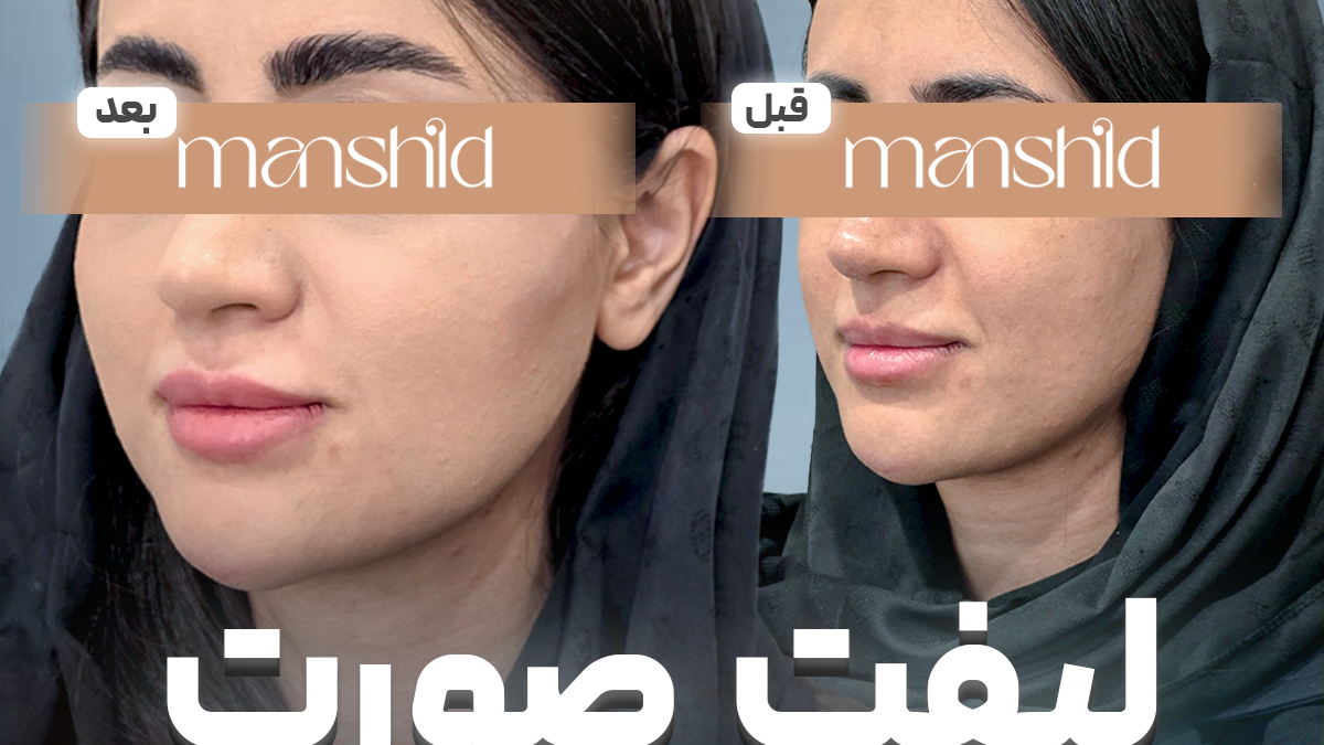 کلینیک زیبایی مانشید