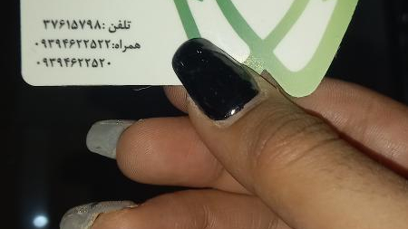 دندانپزشکی دکتر ریحانه بنیادی منش