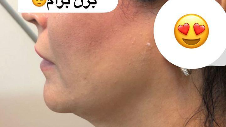 کلینیک زیبایی آیشن