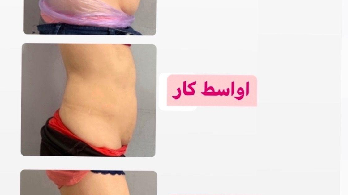کلینیک تغذیه و رژیم درمانی و تناسب اندام (دکتر هانیه روانبخش)