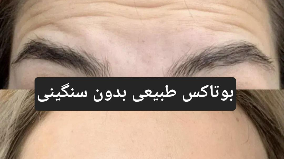 کلینیک لیزر و پوست دکتر فروغ نجفی