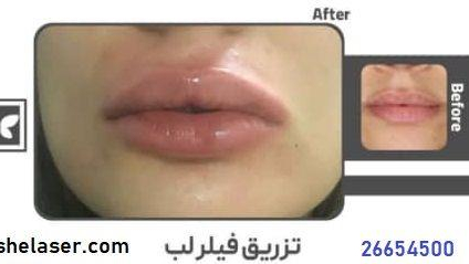 کلینیک زیبایی و لیزر پارادایس