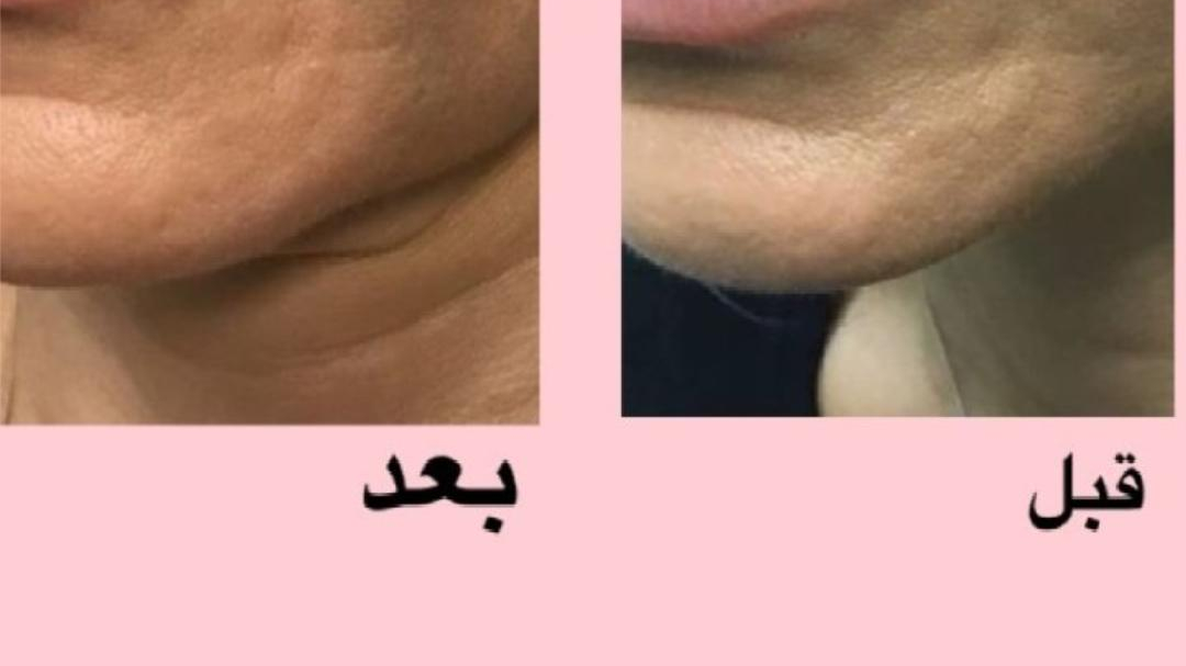 مرکز زیبایی سپیدار دکتر شیرزایی نژاد