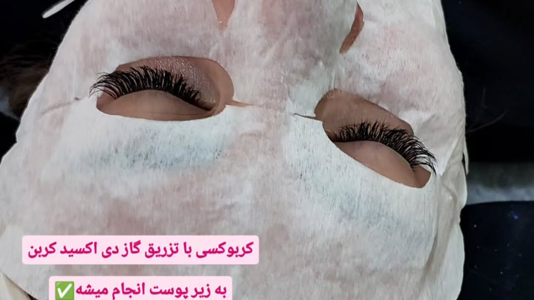 مژگان اسکین کرMojgan skincare