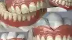دندانسازی محمدی