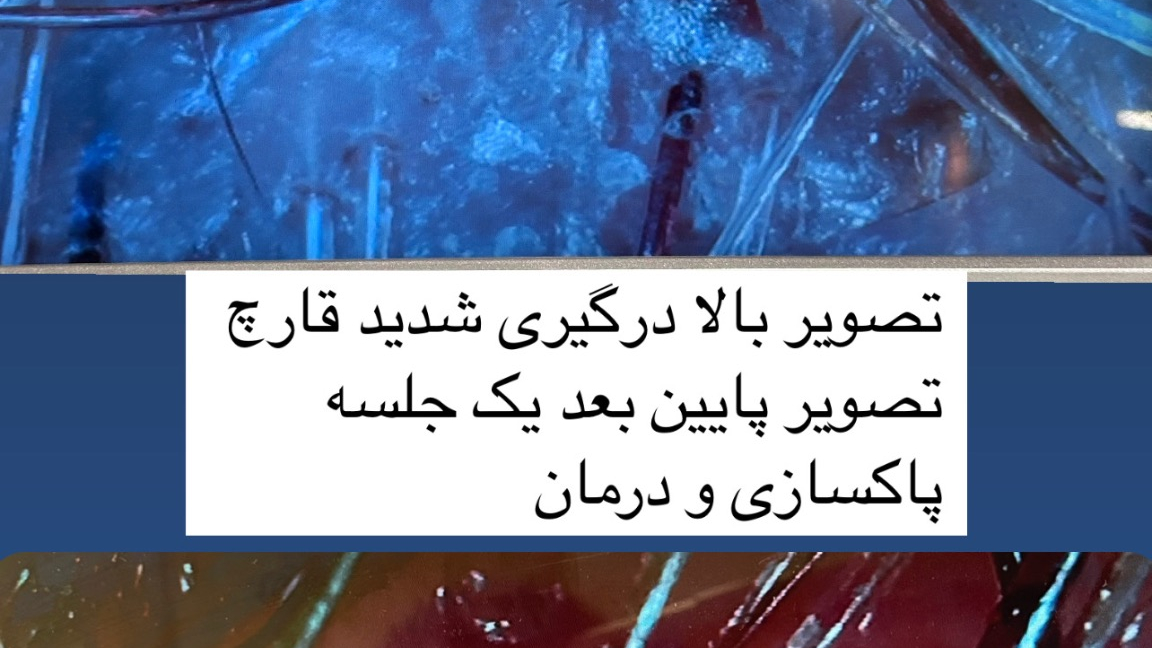 کلینیک پاکسازی و فیشیال پوست سالاری