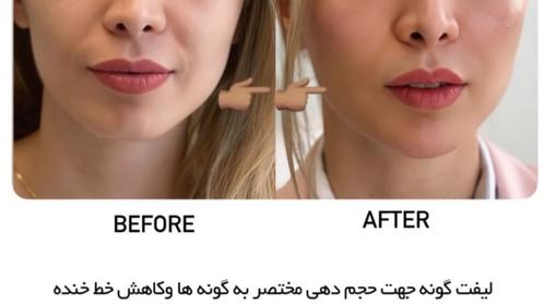 کلینیک تخصصی پوست و مو و لیزر آیلا