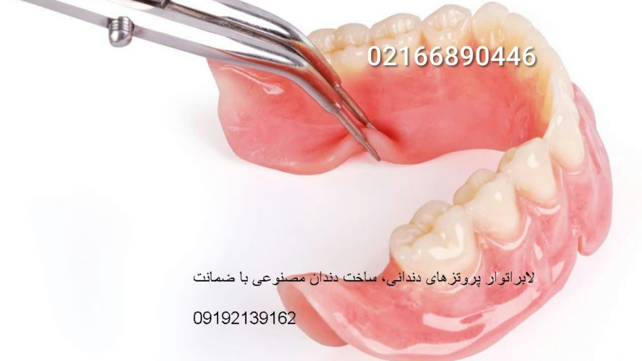 لابراتوار دندانسازی دندان مصنوعی ژله ای نایت گارد دندان سازی ایمپلنت نایتگارد