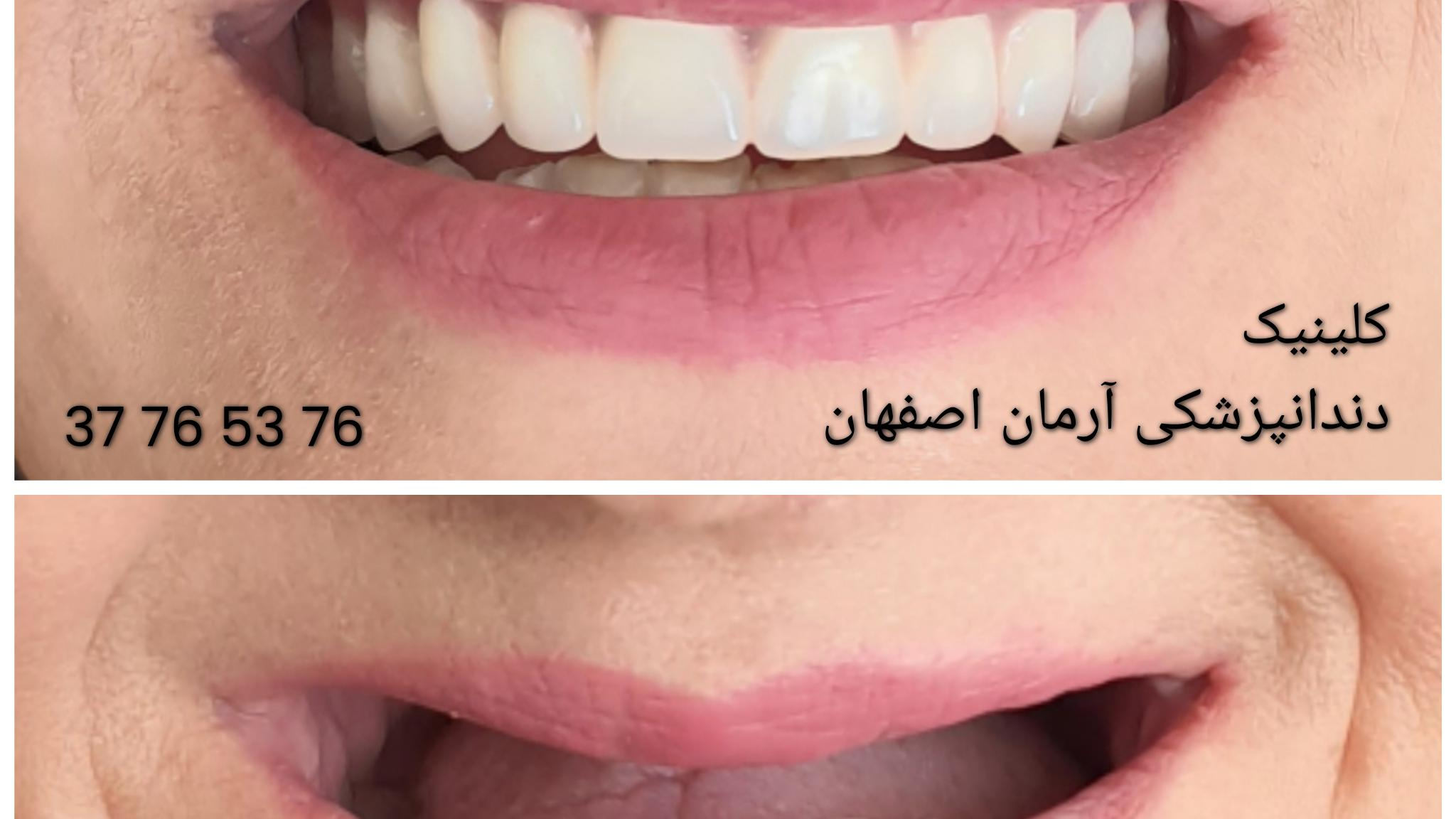 دندانپزشکی آرمان اصفهان